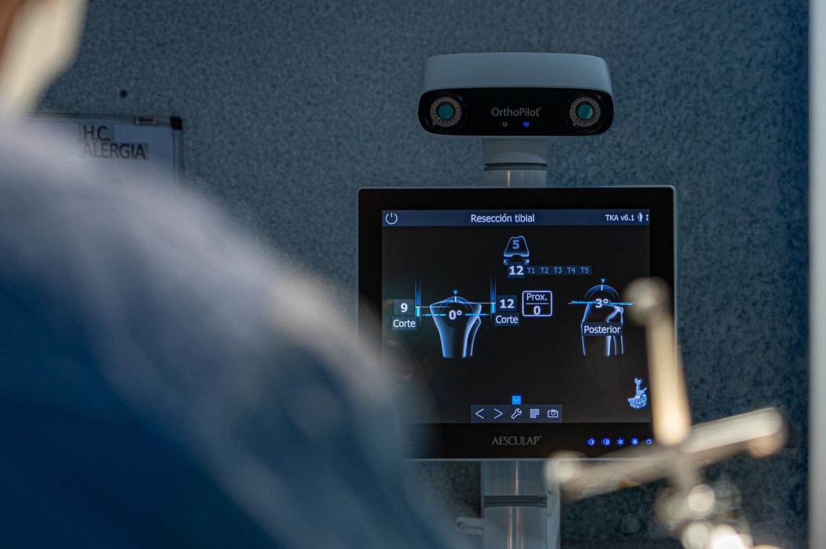 Nuevo navegador de rodilla en Hospital Privado innovación y mayor precisión