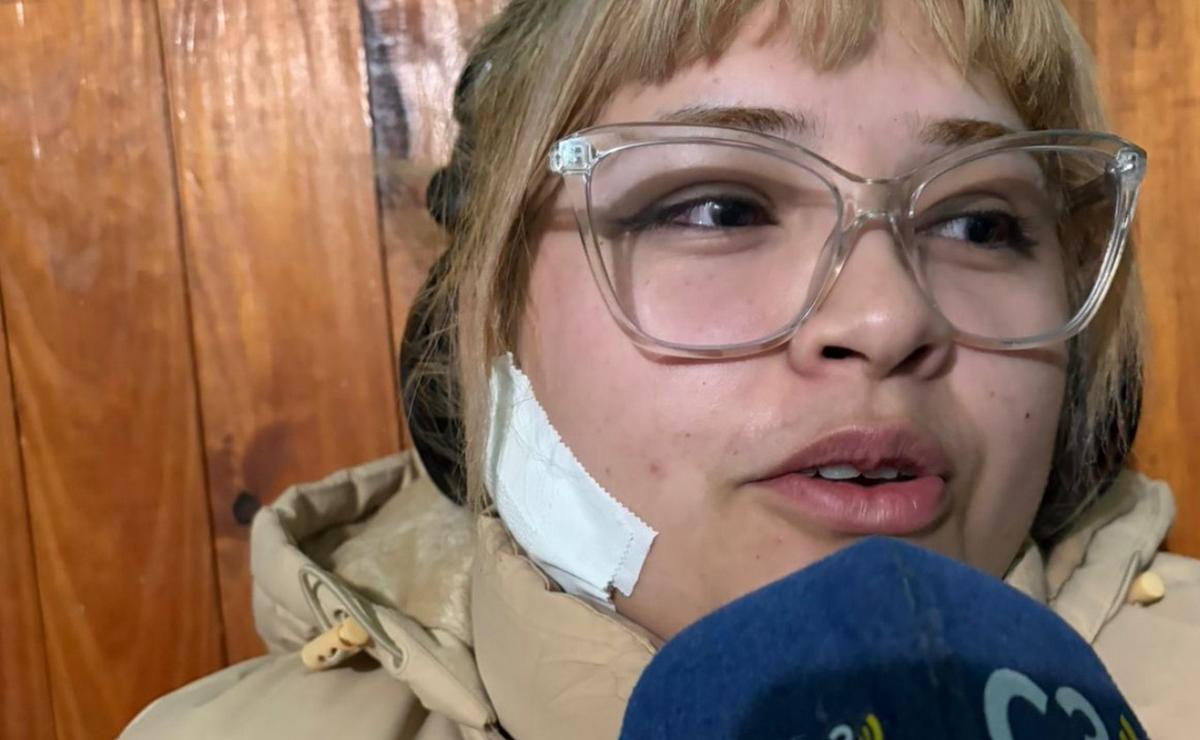 Milagros, la joven que recibió un balinazo en la cara.