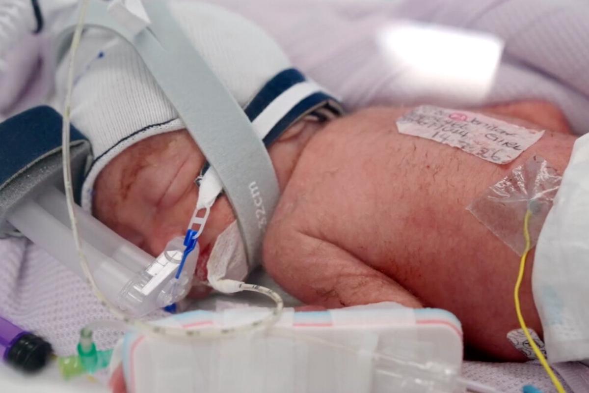 Australiana da a luz a cuatrillizas idénticas después de un embarazo sumamente inusual