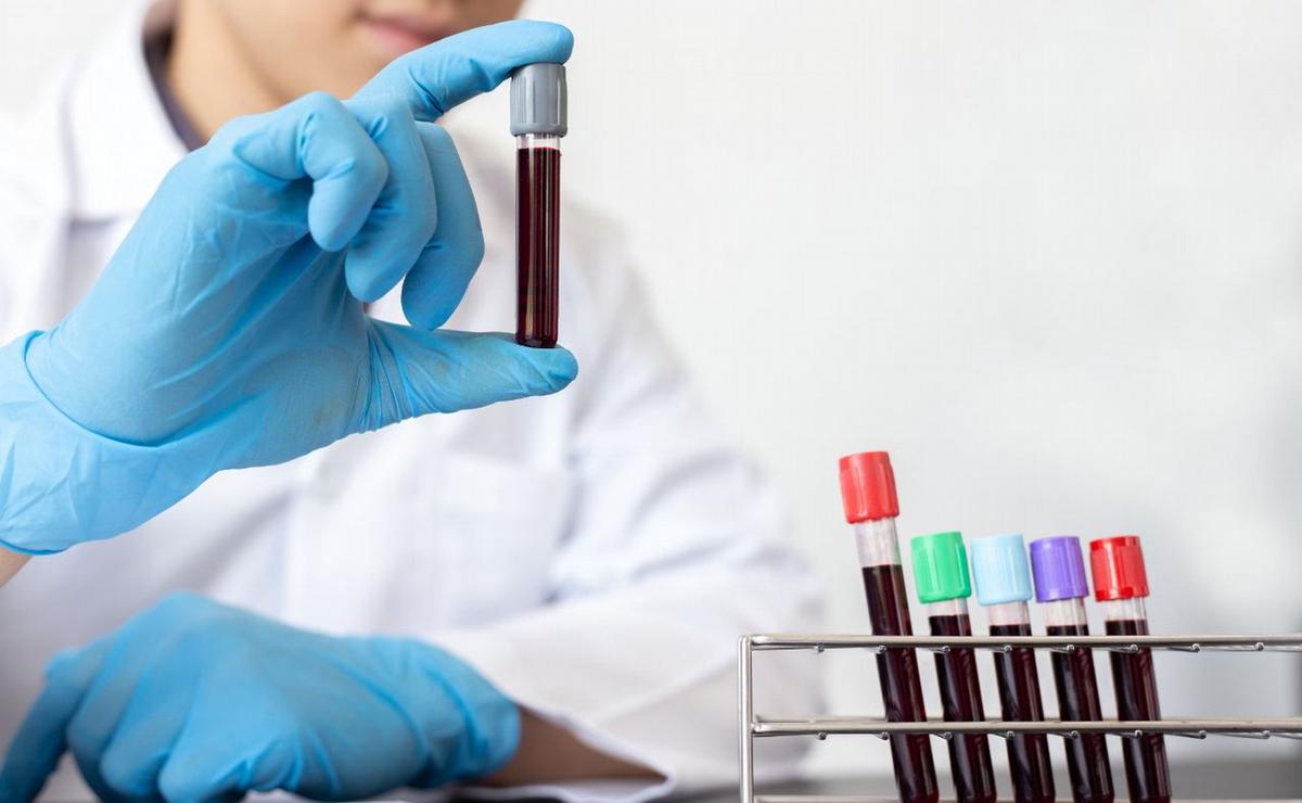 Analisis de sangre