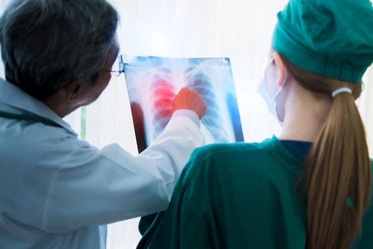 La falta de aire y la tos persistente: señales de fibrosis pulmonar, una enfermedad silenciosa