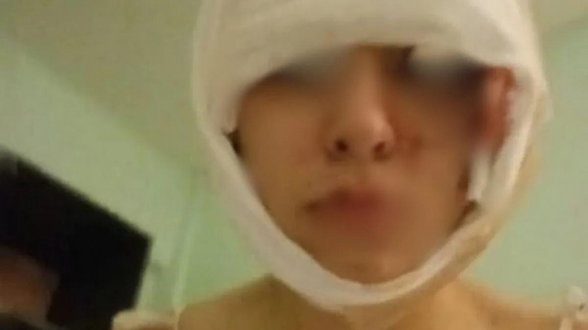 Delfina fue atacada en enero pasado.