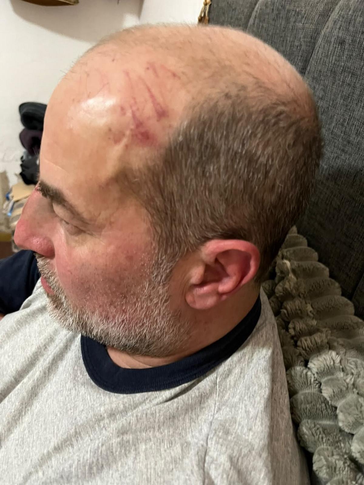 Pablo Marra debió ser internado tras la brutal golpiza.