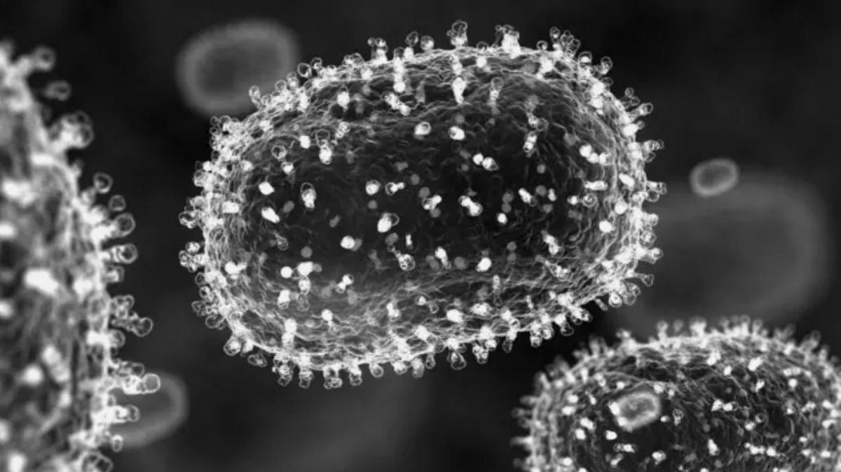 Dos casos de viruela detectados en Santa Cruz, vinculados a importaciones recientes