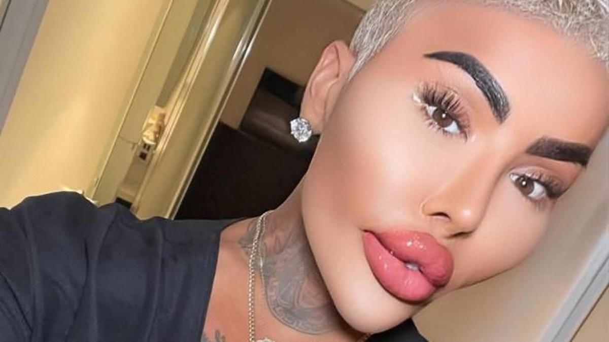 Murió Jordan James Parke, el influencer británico conocido como ''Lip King''