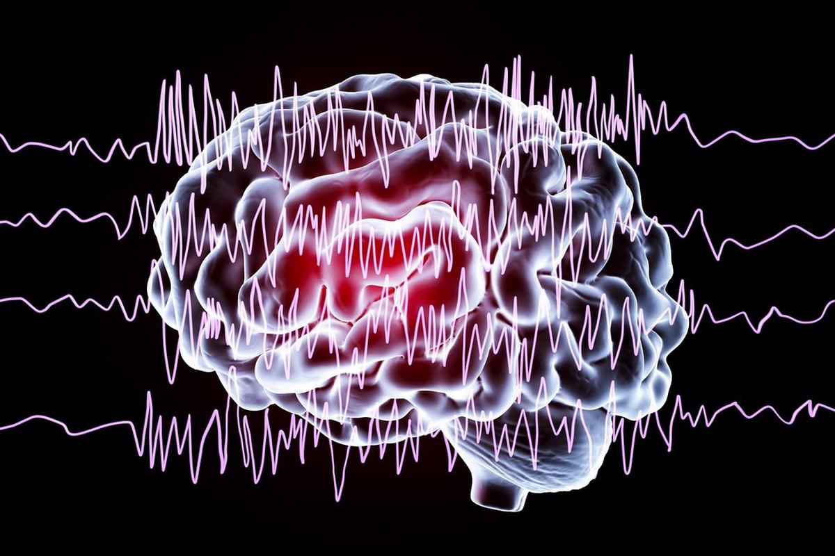 Epilepsia: más allá de las crisis, el impacto emocional y social en los pacientes