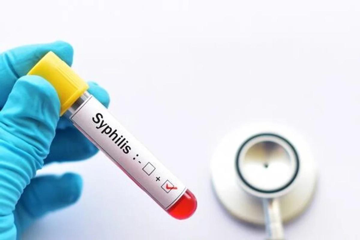 Más de 46.000 casos de sífilis en 2025: un aumento preocupante