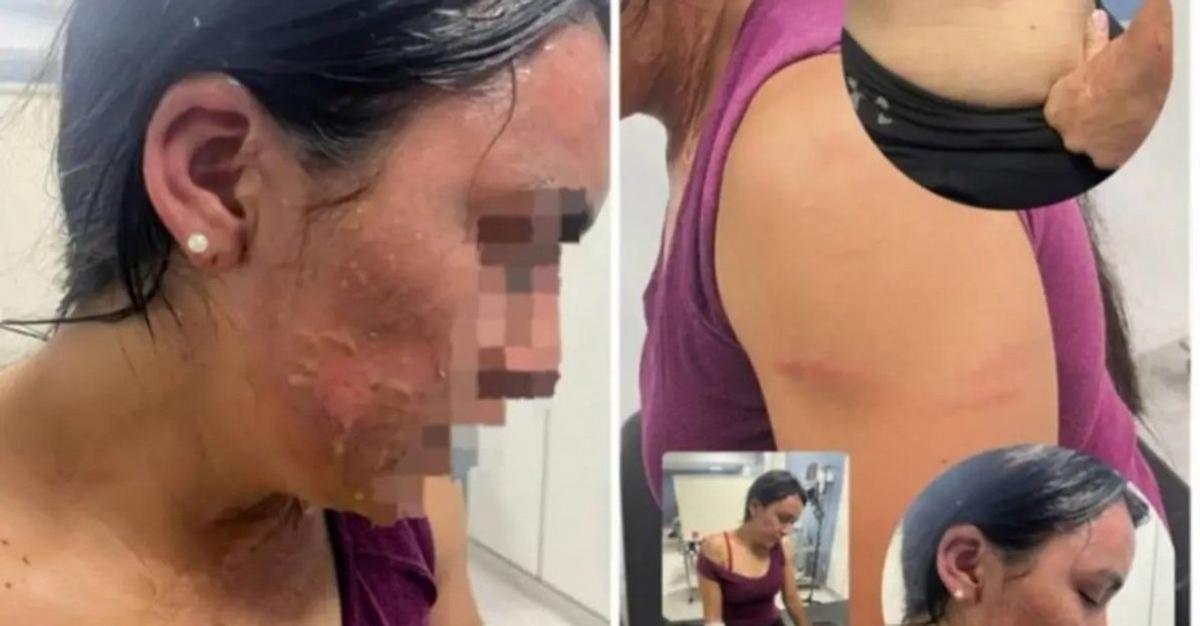 La víctima tras la agresión.