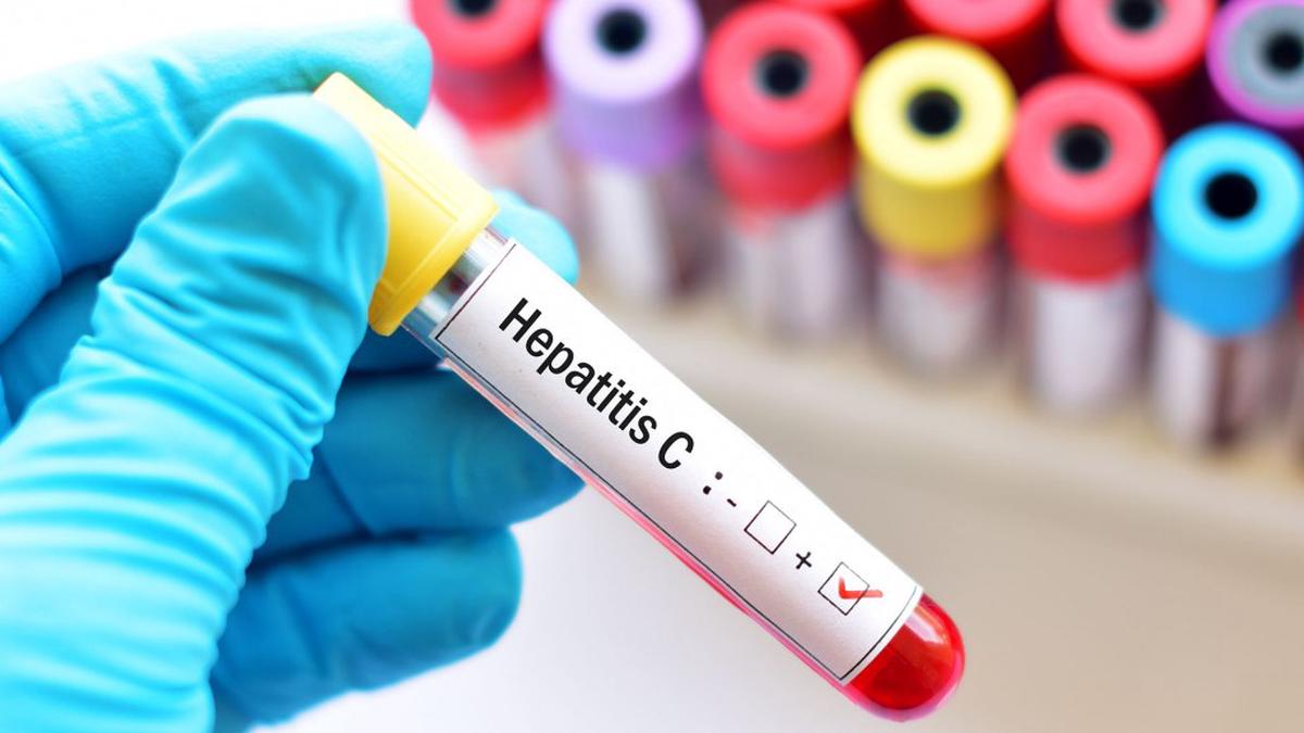 Argentina reporta entre 700 y 800 nuevos casos de Hepatitis C cada año