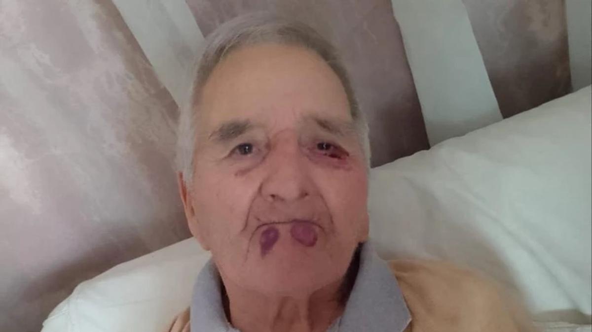 Brutal agresión a un jubilado en un geriátrico de Mar del Plata: video impactante