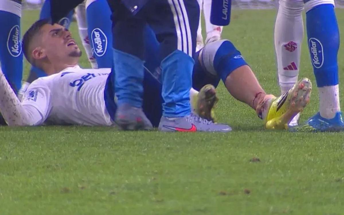 Gabriel Pec, de Cruzeiro, sufrió una fractura en la tibia ante Internacional.