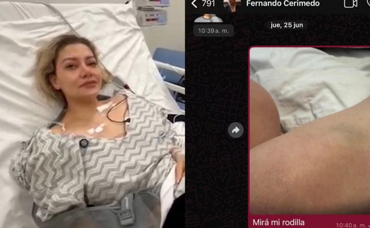 Nadia Beller publicó chats con Cerimedo y mostró fotos de lesiones.