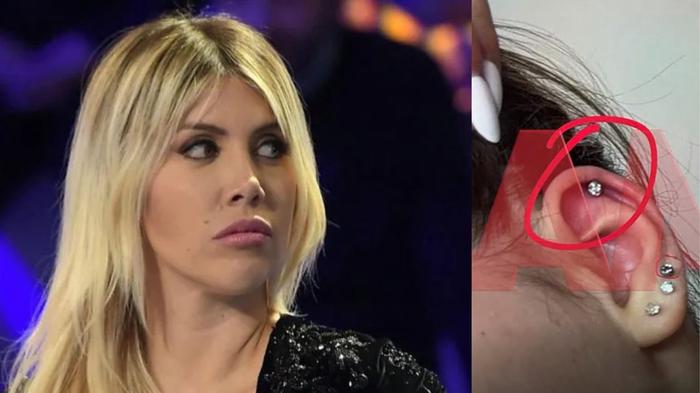 Wanda Nara se opone a piercings en su hija tras infección