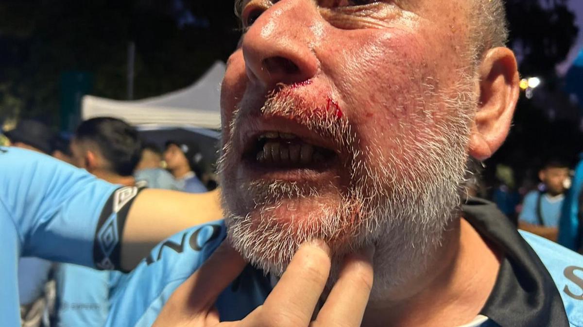 Un hincha de Belgrano, con heridas producto de los incidentes en Rosario.