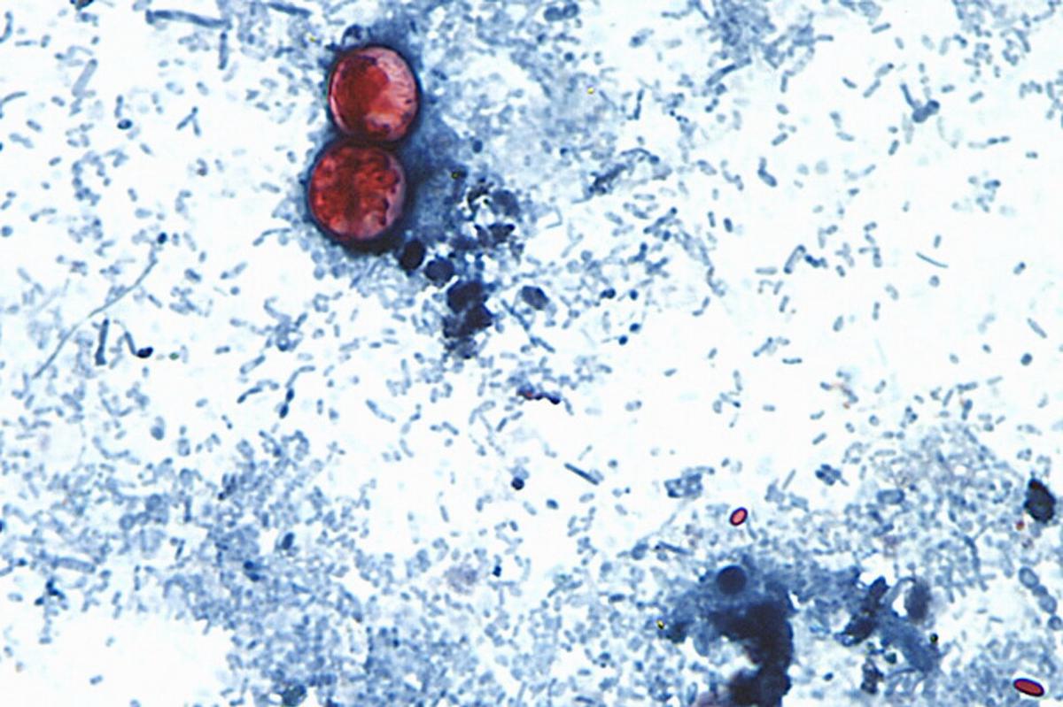 EEUU reporta sus primeras dos muertes por cyclospora, ambas en Michigan