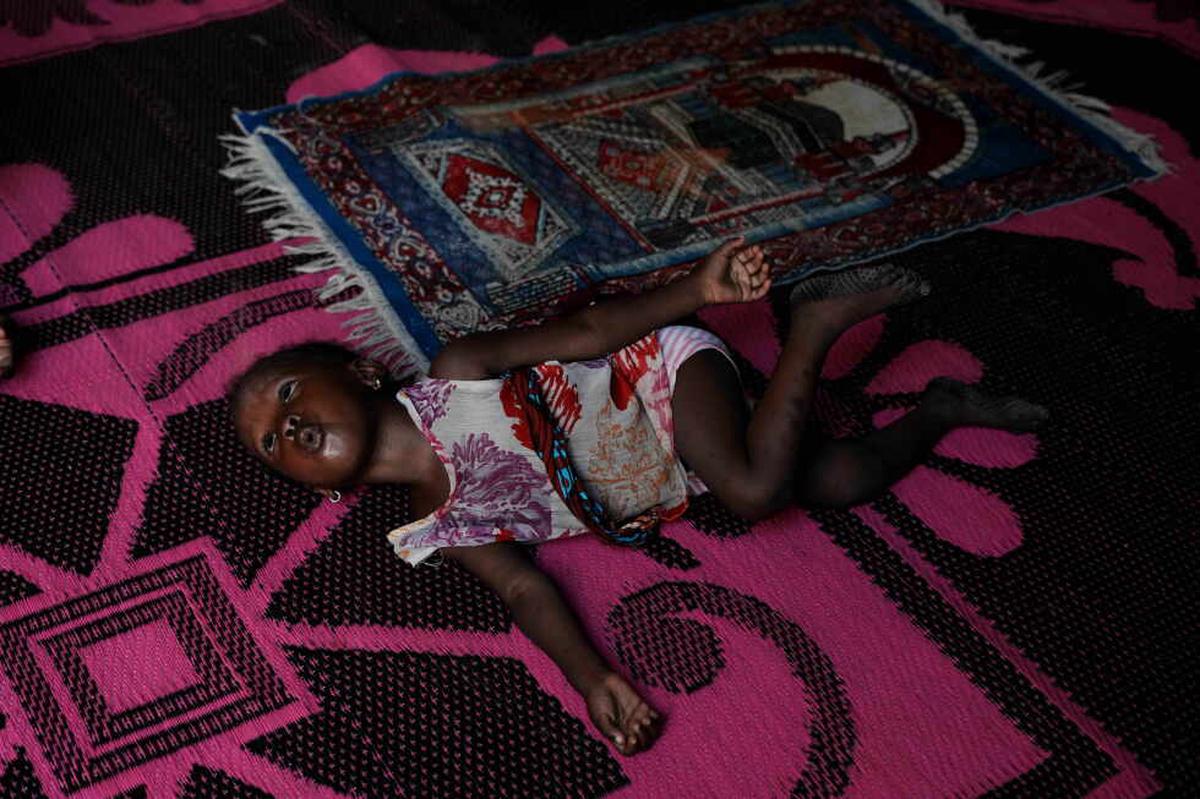 Niños nigerianos pagan el precio de la guerra de Irán: aumentan la desnutrición y la pobreza
