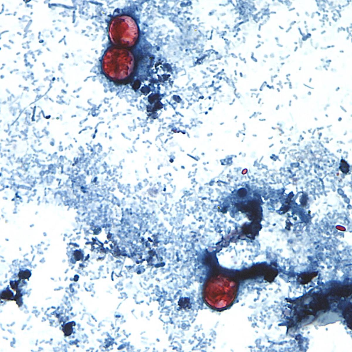 Casi 1.000 casos de cyclospora afectan a Michigan en el mayor brote parasitario del estado