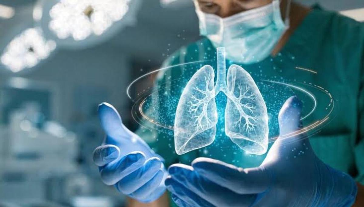 Nódulo pulmonar: claves para identificar su naturaleza benigna o maligna