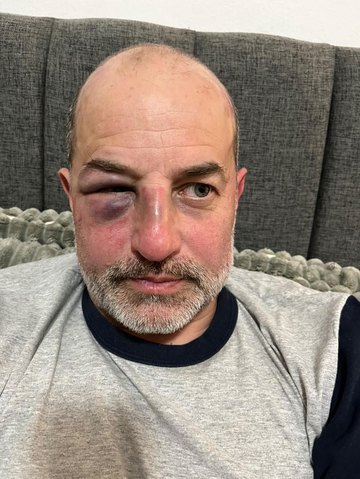 Pablo Marra debió ser internado tras la brutal golpiza.