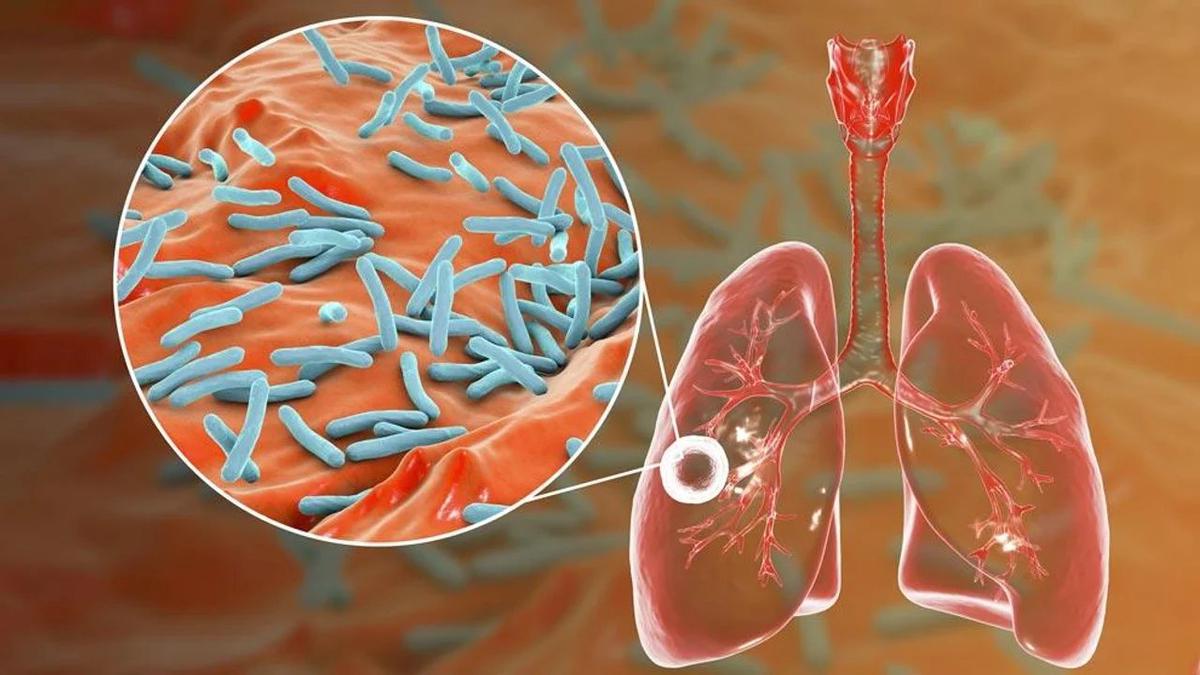 Investigadores de la UBA impulsan una nueva estrategia para tratar la tuberculosis