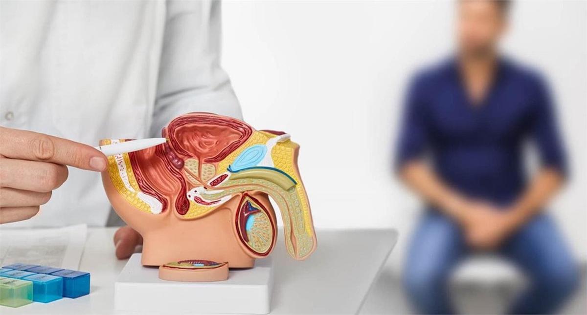 Día del Cáncer de próstata: más de 11.600 diagnósticos anuales en Argentina