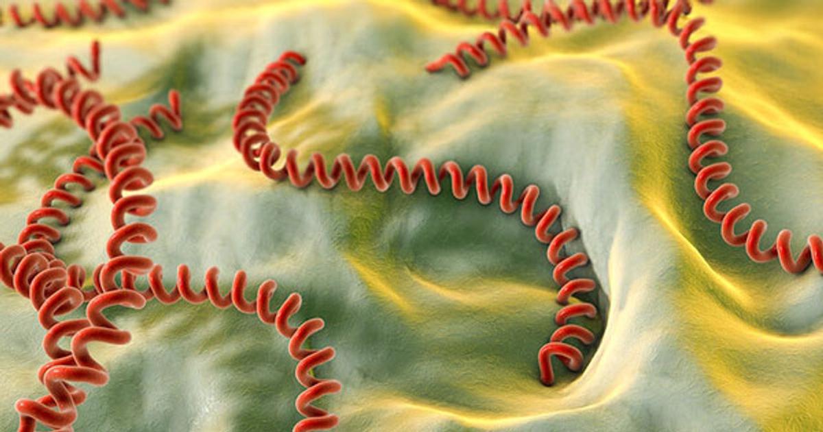 Leptospirosis: 109 casos confirmados en medio de un aumento alarmante