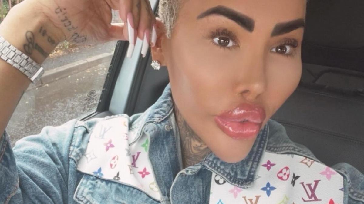 Murió Jordan James Parke, el influencer británico conocido como ''Lip King''