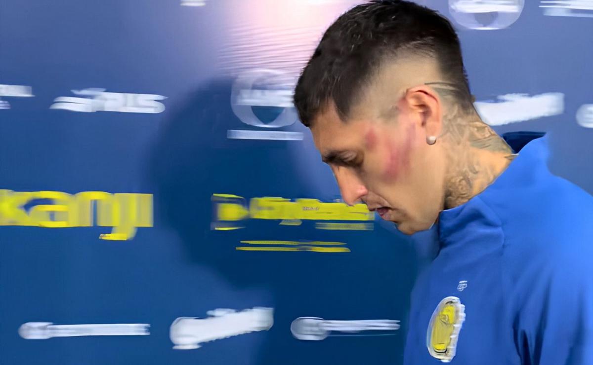 Gastón Ávila con el golpe en su rostro.