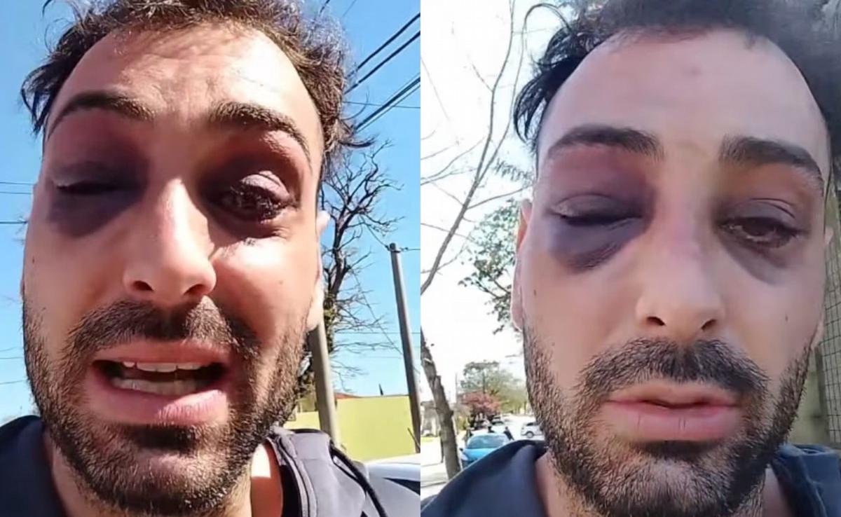 Lautaro Ruiz, el joven que denunció haber sido atacado por una decena de policías en La Pampa. (TN)