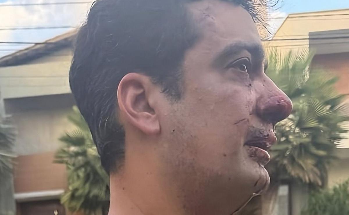 Eros Mancuso estuvo envuelto en un escándalo en Brasil.