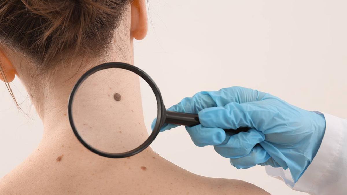 La dermatóloga brindó recomendaciones para cuidarse la piel (Foto ilustrativa)