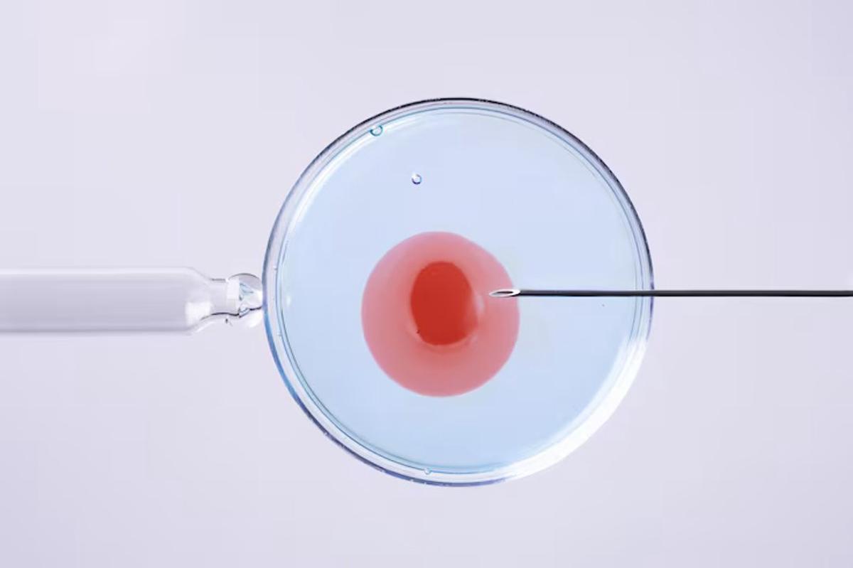 FIV e ICSI: diferencias clave en técnicas de fertilización asistida